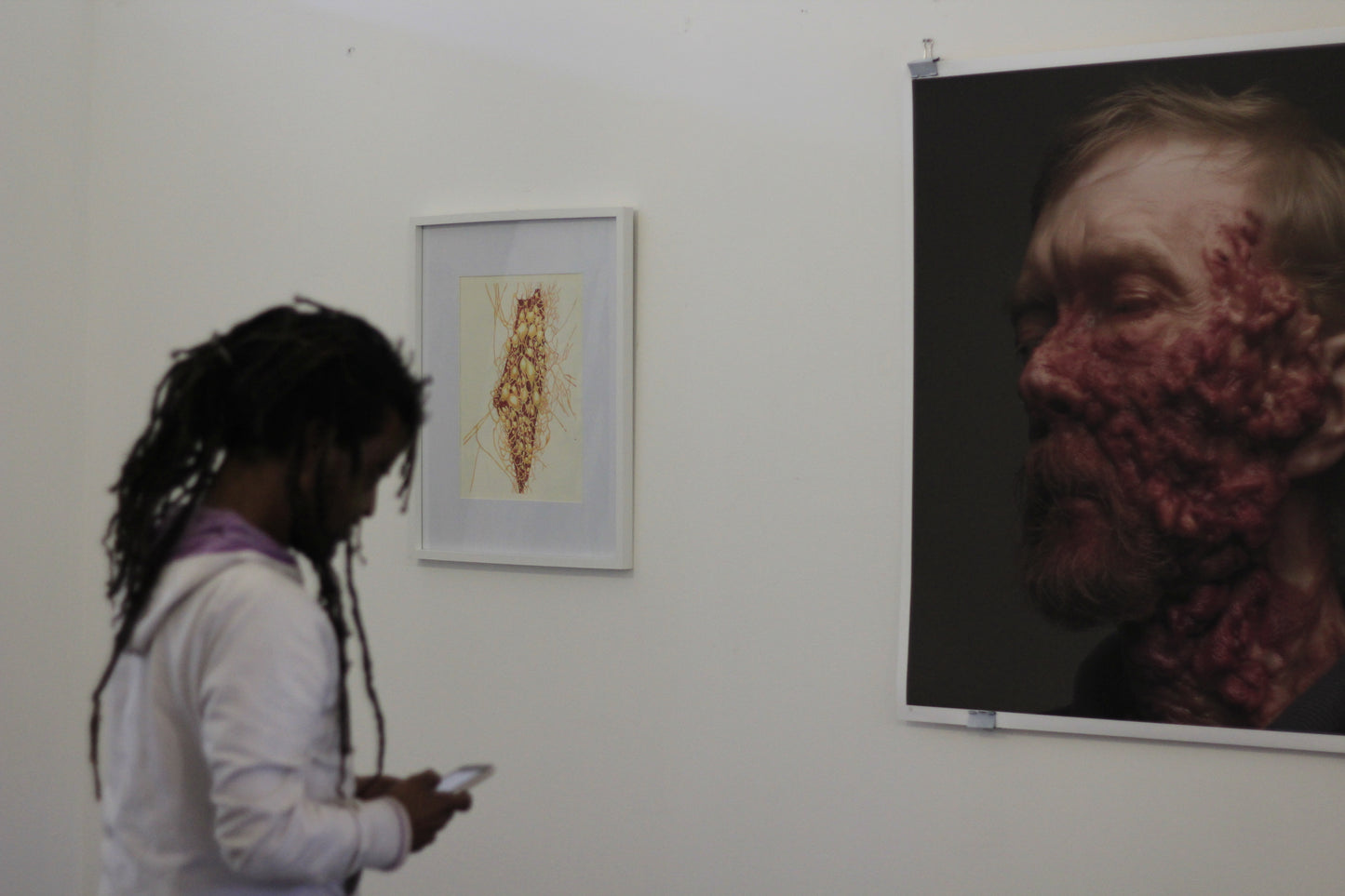 A pathogen  - uncontained